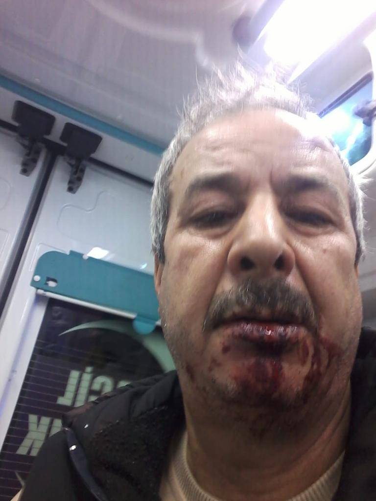 Eyyübiye'de madde bağımlıları dehşet saçıyor