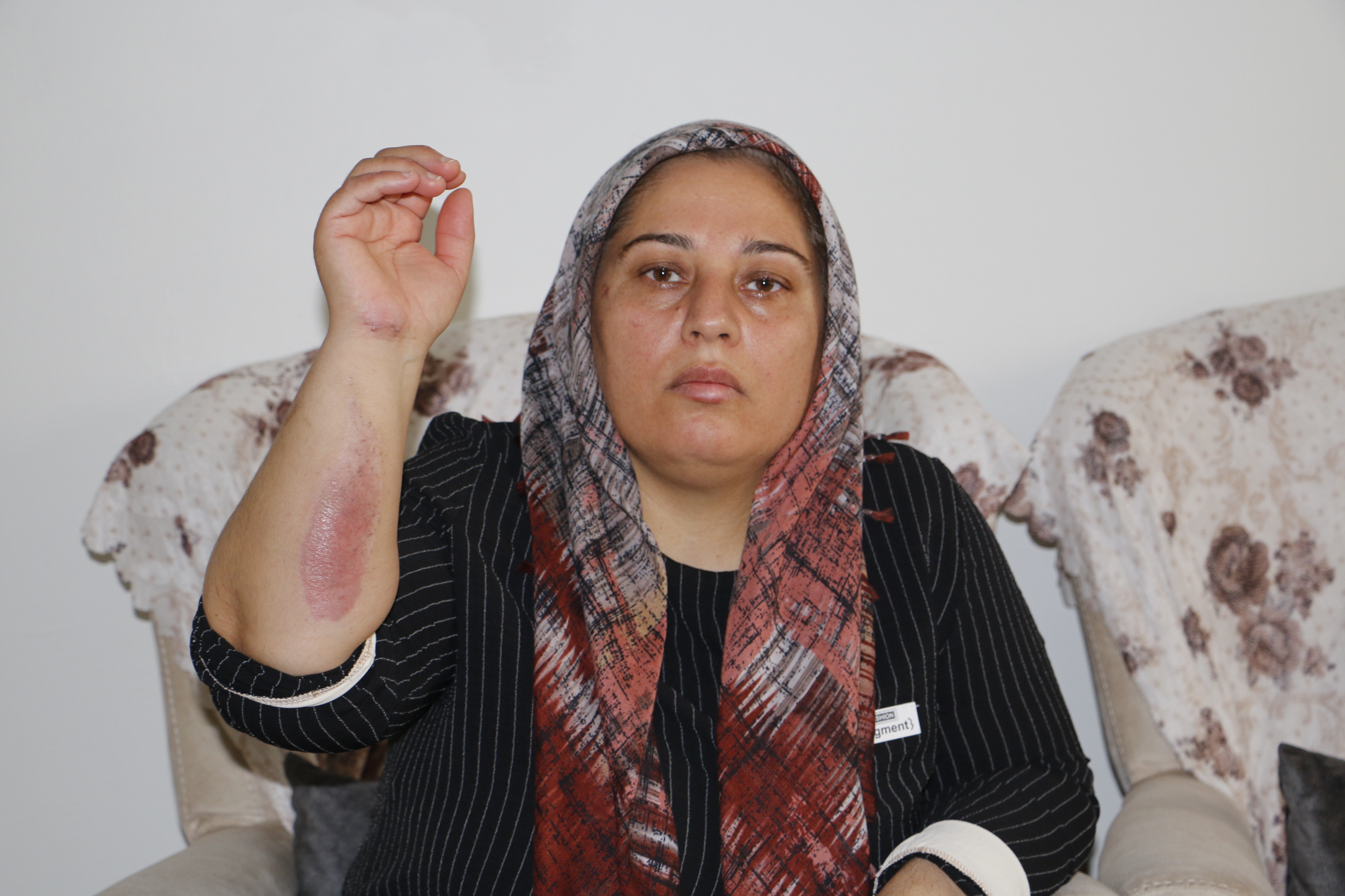 Gaziantep kazasından yaralı kurtulan anne kazayı anlattı