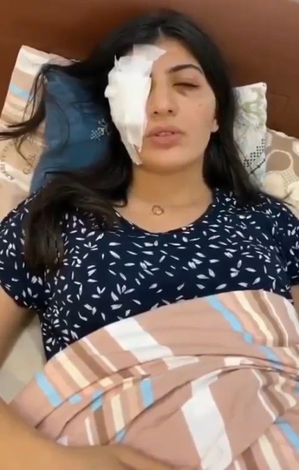 Yolda yürüyen kızların yüzüne yabancı cisim atıp kaçtılar