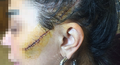 Genç kadının yüzünü usturayla kesen caniye 6 yıl ceza