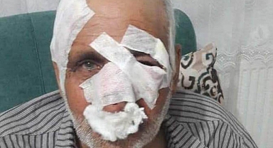 Köpek Saldırısına Uğrayan Vatandaş Hayatını Kaybetti