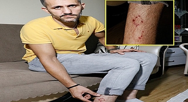 Ailesi ile birlikte sokakta köpek saldırısına uğradı