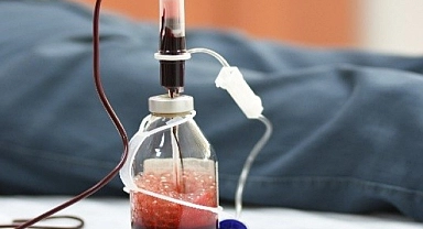 Ozon tedavisi bir çok hastalığa deva