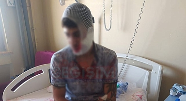 Şanlıurfa'da önce motorsikletini çaldılar, sonra satırla dövdüler