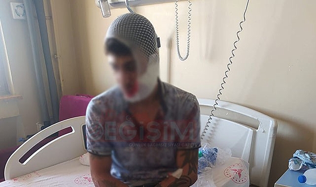 Şanlıurfa'da önce motorsikletini çaldılar, sonra satırla dövdüler