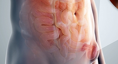 Kasık fıtığı erkeklerde kadınlara göre 9 kat daha fazla görülüyor