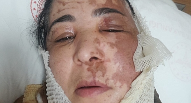 Adana’da üvey evlat vahşeti