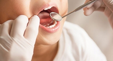 Flor diş çürüklerini yüzde 20 ile 40 arasında engelliyor