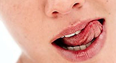 Dudak çatlamasına karşı alınması gereken 7 önlem