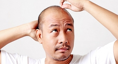 Kellere müjde, bu tedavi genetik kelliği önlüyor