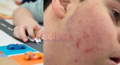 Rehabilitasyon merkezinde otizmli çocuklara şiddet iddiası