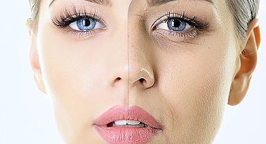 Estetikte ip askı yöntemi gençleştiriyor