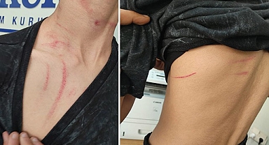 "Oruç tutmadığı için darp edildi" iddiası asılsız çıktı!