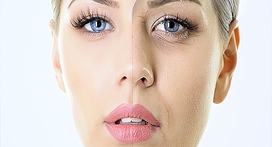 Yargıtay'dan estetik mağdurlarını sevindiren karar!