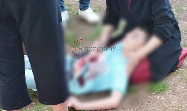 Urfa'da çocukların kavgasında kan aktı