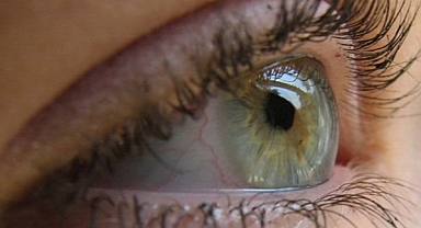 Göz alerjisi kişinin yaşam kalitesini olumsuz etkiliyor