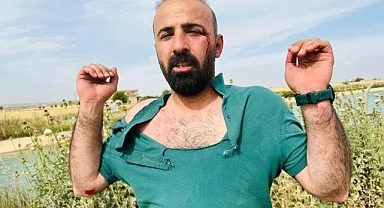 HDP Şanlıurfa İl Başkanı ve avukatlar saldırıya uğradı!