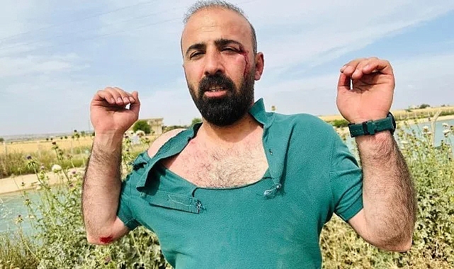HDP Şanlıurfa İl Başkanı ve avukatlar saldırıya uğradı!