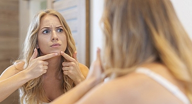 Sivilce ergenliğe özgü bir durum değil, bir hastalıktır