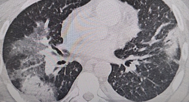 “Klima temizliğine önem verin, uzun süre maruz kalmayın”