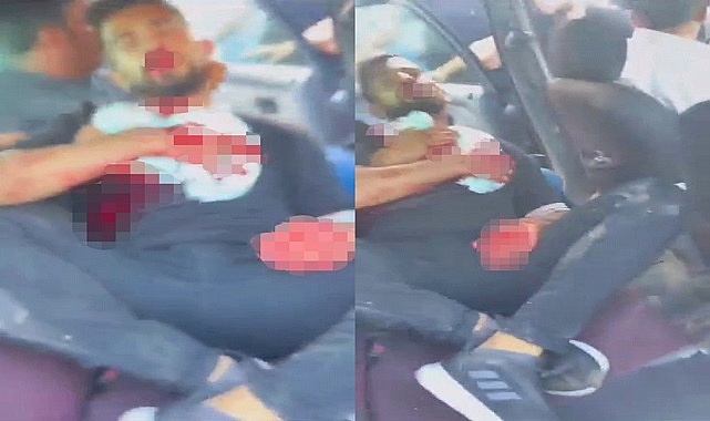 Urfa'da akraba iki aile arasında silahlı kavga: 1'i ağır 5 yaralı