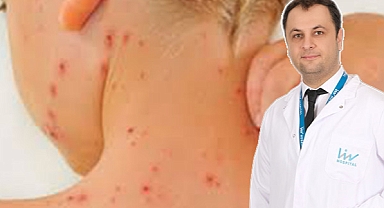 Kızamıktan nasıl korunur