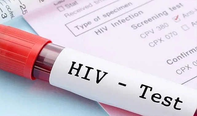 HIV-AIDS’te erken teşhis ve düzenli takip ölümleri azaltıyor