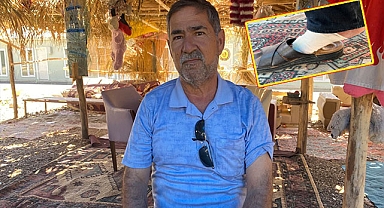 Kesilecek denen ayağı merhemle iyileşti