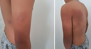 Şanlıurfa'da zincirle işkence iddiası!