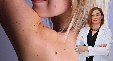 Benlerinizdeki renk değişimi kanser habercisi olabilir