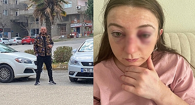 Kadına şiddetin adresi bu sefer Bursa!