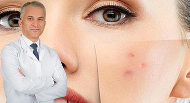 Cildiniz en küçük bir çarpmada bile morarıyorsa dikkat