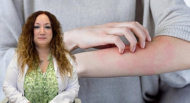 Uzmandan korkutan “uyuz” açıklaması!