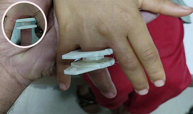 Şanlıurfa'da parmağına plastik parçası sıkışan çocuğu itfaiye kurtardı