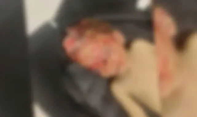 Şanlıurfa merkezde 1 yaşındaki çocuğu kamyon ezdi!