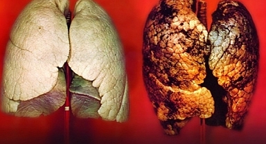 Sigara kullananlar dikkat! Uzman uyardı