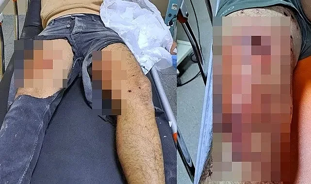 Urfa'da çocuklar silahlı kavgaya neden oldu! 2'si ağır 5 yaralı