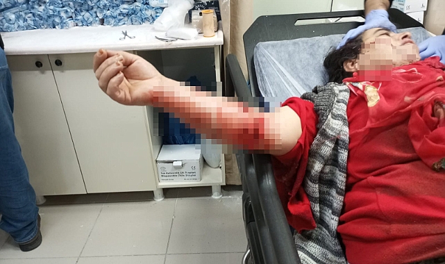 Köpeklerin saldırısına uğrayan kadın yaralandı