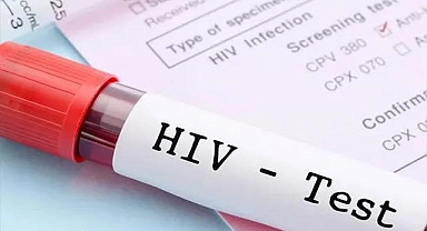 Prof. Dr. Haluk Erdoğan: "2010'dan bu yana HIV ile yaşayan birey sayısı 9 kat arttı"