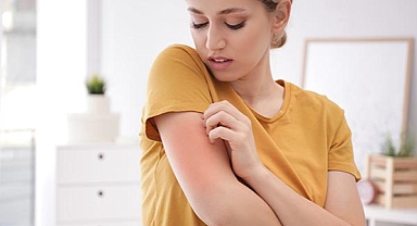 Uyuz salgınında tehlike geçmedi, vakalar artıyor