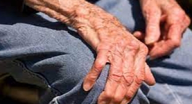 ‘Kemik erimesi ölüme yol açabilir’