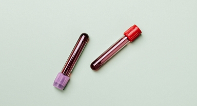 'Kırmızı kan hücrelerinin azalması anemiye yol açıyor'