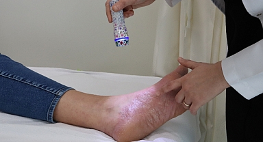 Soğuk havalar deri hastalıklarını da tetikliyor