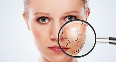 Güneşle gelen cilt lekelerine dikkat! Uzman uyardı