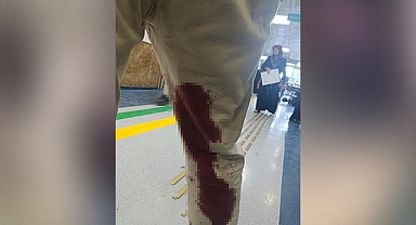 Şanlıurfa'da sokak köpeğinin saldırısına uğrayan kişi yaralandı