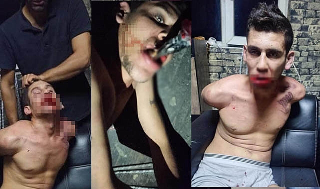 İşkence yapıp böcek yedirdiler, kerpetenle dişlerini söktüler! Urfalı genç konuştu