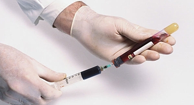 Uzm. Dr. Yılmaz: “Yılda 1 milyon kişiyi öldüren hepatitten korunmanın tek yolu aşı”