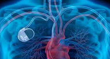 Kalıcı kalp pili olanlar dikkat...Uyulması gereken 8 önemli kural