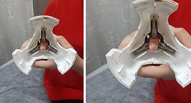 Şanlıurfa'da 12 yaşındaki çocuk parmağını zeytin çizme aparatına kaptırdı!