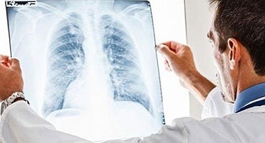 Uzman uyardı! "Zatürre bulaşıcı olduğu kadar, ölümcül bir salgındır”